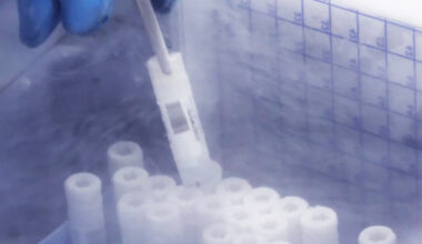 Biobanking – Sample storage for clinical trials – GMP and Non-GMP Biostorage
